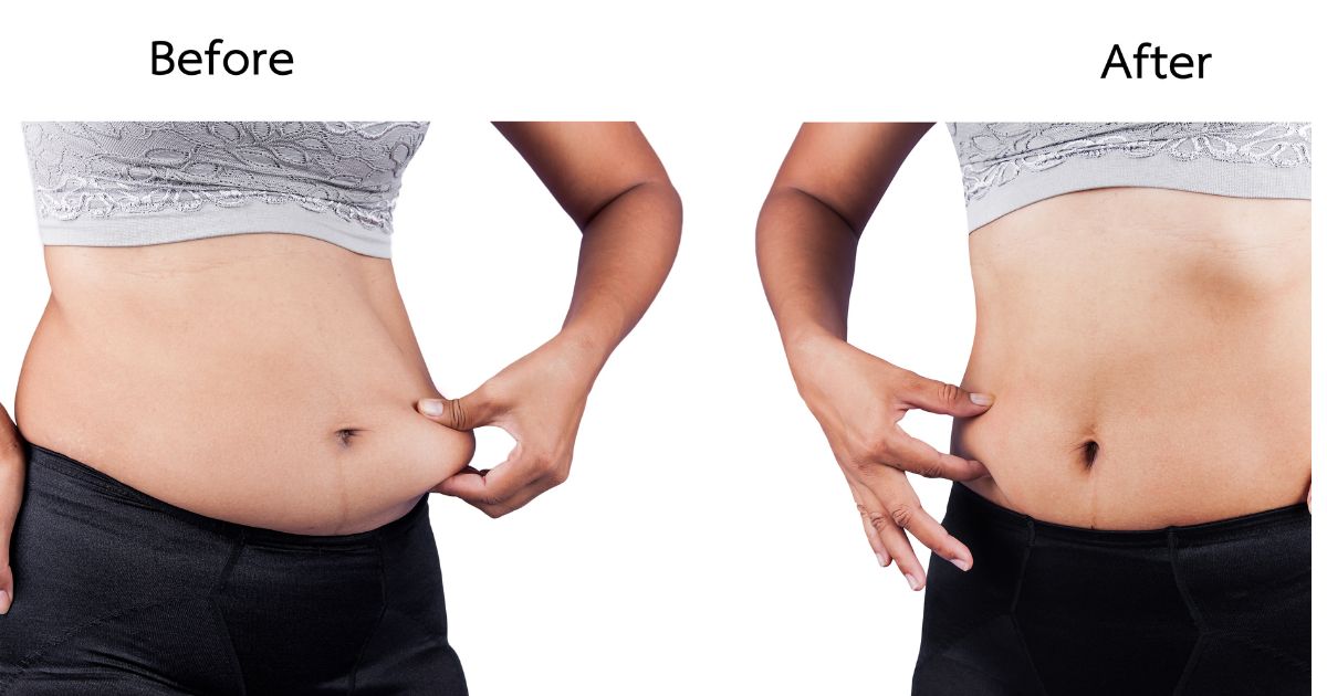 Como a suplementação pode ajudar na perda de gordura