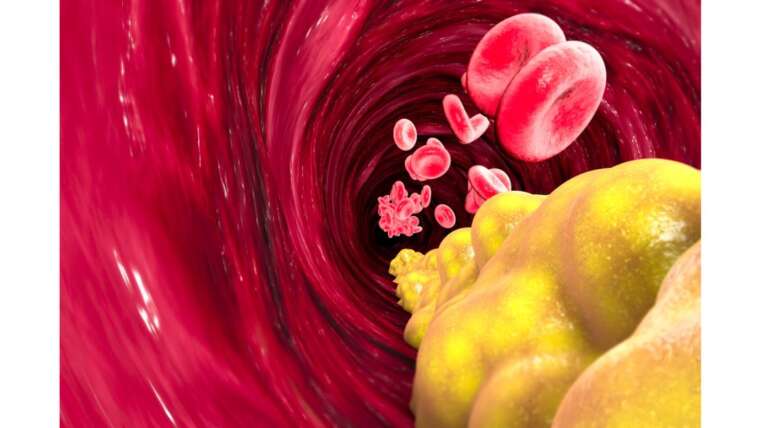 Whey Protein aumenta o colesterol: isso mito ou verdade?