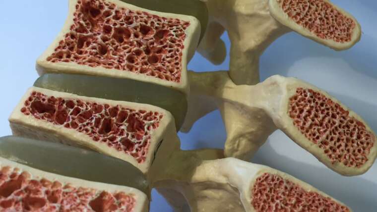 Whey protein e vitamina K: melhore a saúde óssea e previna a osteoporose